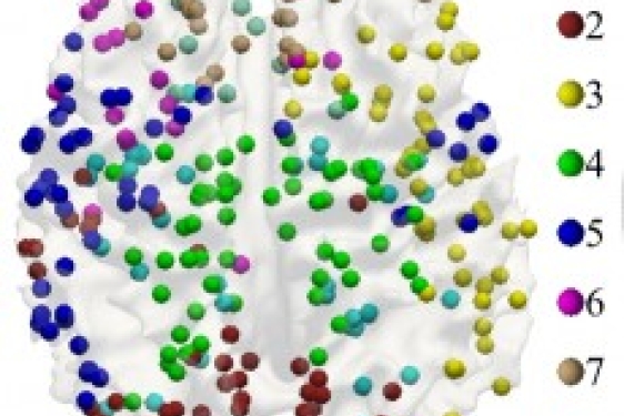 human brain with colored plot points.